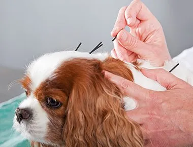 Acupuncture
