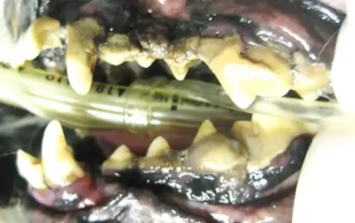 Stage 3 (where some teeth may actually be early stage 4.