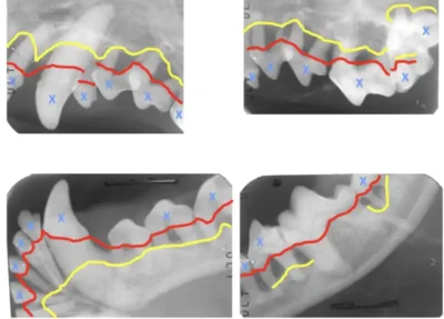 Stage 4 Periodontal disease radiographs